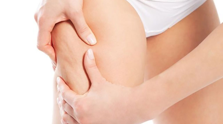 Retención de líquidos