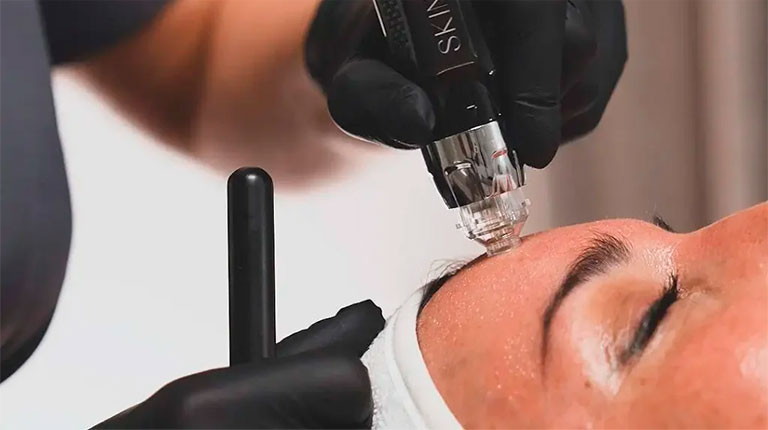 Dermapen con Exosomas