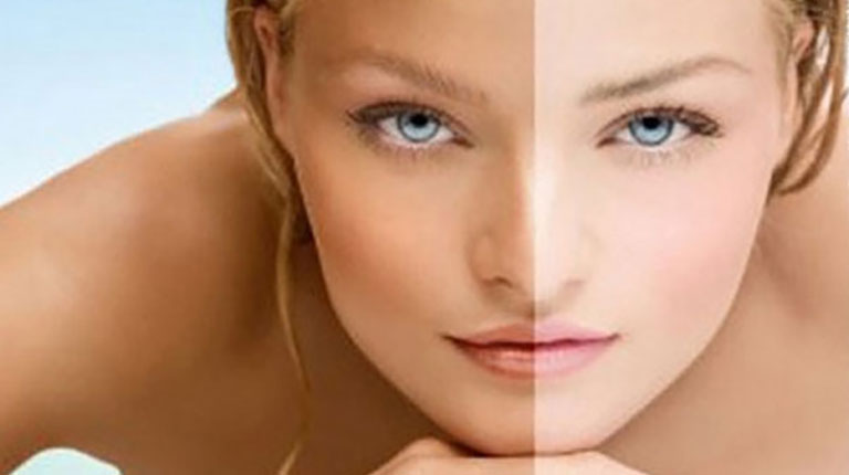 Despigmentación de la piel